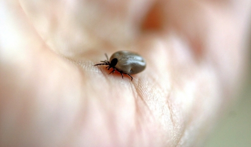 Removing Ticks From Your Pets