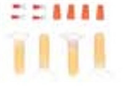 Underground Sprinkler Grease Cap Kit